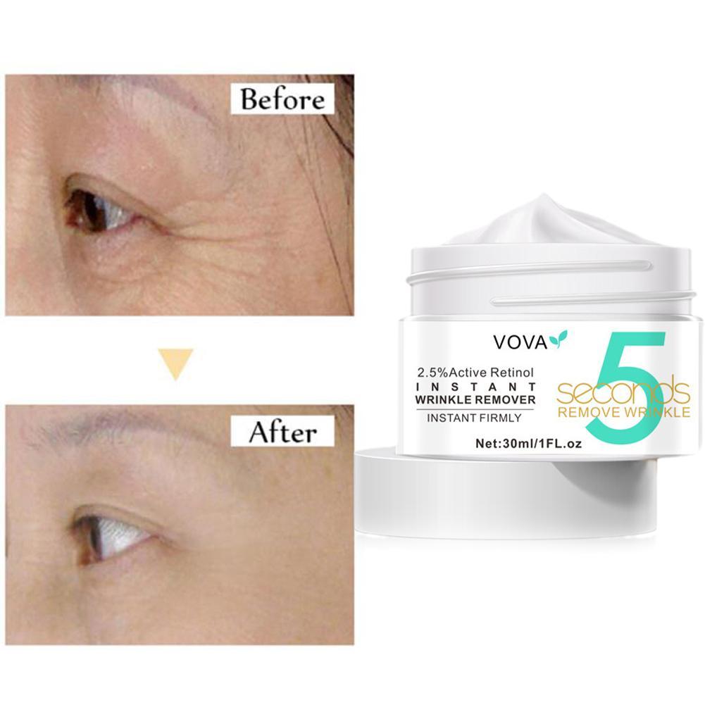 2.5% Active Retinol Eye Cream  – обзор и цена Milk Thistle Silymarin